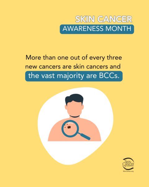 skin-cancer-awareness Skin Cancer Awareness Month image with a person examining a mole with a magnifying glass, alongside the statistic that more than one out of every three new cancers are skin cancers.