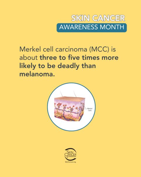 skin-cancer-awareness-month-image Informational image about Merkel cell carcinoma (MCC), stating it is about three to five times more likely to be deadly than melanoma, accompanied by a diagram of Merkel cells in the skin. The image is promoting Skin Cancer Awareness Month and features the Skin Cancer Foundation logo.