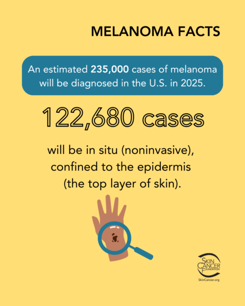 melanoma facts 122k cases melanoma facts 122k cases